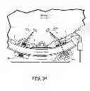 Fig. 28 - Magnetic-anchored robotic system