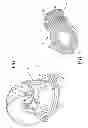 Fig. 02 - MOUTH GUARD RETAINING DEVICE
