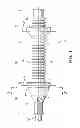 Fig. 02 - Grommet