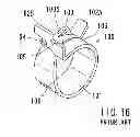 Fig. 07 - Hose clamp