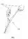 Fig. 02 - HIGH LOAD RELEASE DEVICE