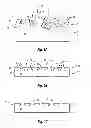 Fig. 04 - Method of manufacturing an orthodontic bracket having a laser shaped green body