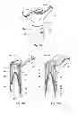 Fig. 04 - Tool for separating flesh from a core and a rind of a fruit