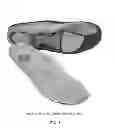 Fig. 02 - INSOLE AND FOOT ORTHOTICS MADE OF SHAPE MEMORY MATERIAL (SMM) THREE-DIMENSIONAL SPACER FABRICS