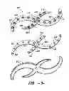 Fig. 04 - Spray arm assembly for a dishwasher appliance
