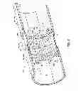 Fig. 04 - Structured RF coil assembly for MRI scanner