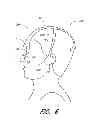Fig. 17 - Wearable electronically enabled interface system
