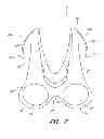 Fig. 18 - Wearable electronically enabled interface system