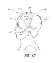 Fig. 27 - Wearable electronically enabled interface system