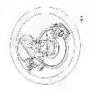 Fig. 04 - Dynamic biplane roentgen stereophotogrammetric analysis