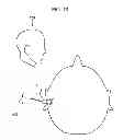 Fig. 11 - Earphone device