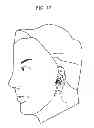 Fig. 13 - Earphone device