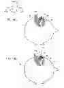Fig. 17 - Earphone device