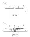Fig. 03 - Electroadhesive conveying surfaces