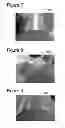 Fig. 07 - Systems and methods for ingot grinding