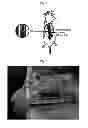 Fig. 02 - COMPOSITIONS AND METHODS FOR AMELIORATING RENAL DYSFUNCTION INDUCED BY RENAL HYPOPERFUSION OR ACUTE KIDNEY INJURY