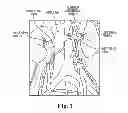 Fig. 02 - SYSTEM AND METHOD OF TRANS-VENOUS PRE-AORTIC GANGLION ABLATION