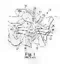 Fig. 02 - Surgical kit for securing an implantable sling in a pubic region