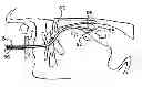Fig. 01 - Oral device and method for the use thereof