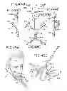Fig. 10 - Oral device and method for the use thereof