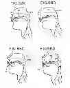 Fig. 30 - Oral device and method for the use thereof