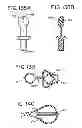 Fig. 41 - Oral device and method for the use thereof