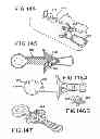 Fig. 43 - Oral device and method for the use thereof