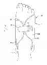 Fig. 01 - Pneumatic compression garment with noise attenuation