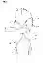 Fig. 02 - Pneumatic compression garment with noise attenuation