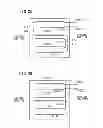 Fig. 04 - BALLOON CATHETER AND ELECTRIFICATION SYSTEM