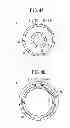 Fig. 05 - BALLOON CATHETER AND ELECTRIFICATION SYSTEM
