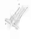 Fig. 09 - VACUUM ANCHORING CATHETER