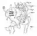 Fig. 01 - Fenestrated implant