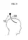Fig. 09 - Implanter device for nerve stimulation and method of using the same