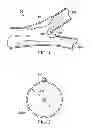 Fig. 02 - Deployment of stents within bifurcated vessels