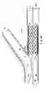 Fig. 08 - Deployment of stents within bifurcated vessels