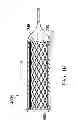 Fig. 10 - Deployment of stents within bifurcated vessels