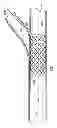 Fig. 15 - Deployment of stents within bifurcated vessels