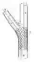 Fig. 17 - Deployment of stents within bifurcated vessels