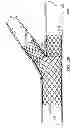 Fig. 19 - Deployment of stents within bifurcated vessels
