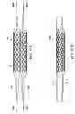 Fig. 22 - Deployment of stents within bifurcated vessels