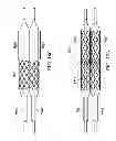 Fig. 23 - Deployment of stents within bifurcated vessels