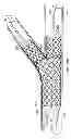 Fig. 24 - Deployment of stents within bifurcated vessels