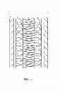 Fig. 18 - PROTECTIVE PADDING UTILIZING SUPERELASTIC THREE-DIMENSIONAL SPACER FABRIC COMPRISING SHAPE MEMORY MATERIALS (SMM)