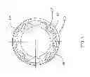 Fig. 04 - HUB ASSEMBLY HAVING RECONFIGURABLE ROTATIONAL MODES