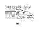 Fig. 07 - Tissue stop for surgical instrument