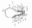 Fig. 15 - LED-based light bulb device