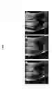 Fig. 08 - Metallic object MR imaging quality control system