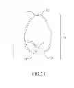 Fig. 12 - SPRING CLIP MOUNTED TO WITHDRAWABLE ARTIFICIAL TOOTH AND REMOVABLE ARTIFICIAL TOOTH ASSEMBLED WITH SAME