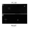Fig. 07 - Differentiation of Bone Marrow Cells into Neuronal Cells and Uses Therefor